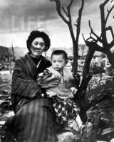 Mother and Child 4 months After Atomic Bomb, Hiroshima 1946 by Alfred Eisenstaedt